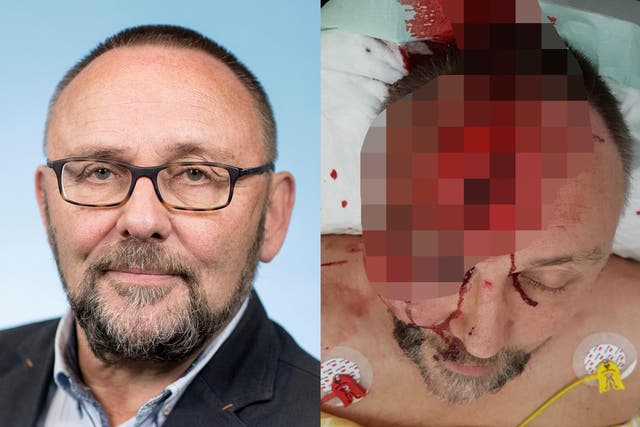 The AfD released a graphic photo of the injuries suffered by Frank Magnitz
