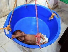 UN admits key Yemen truce failing as aid groups warn of food crisis