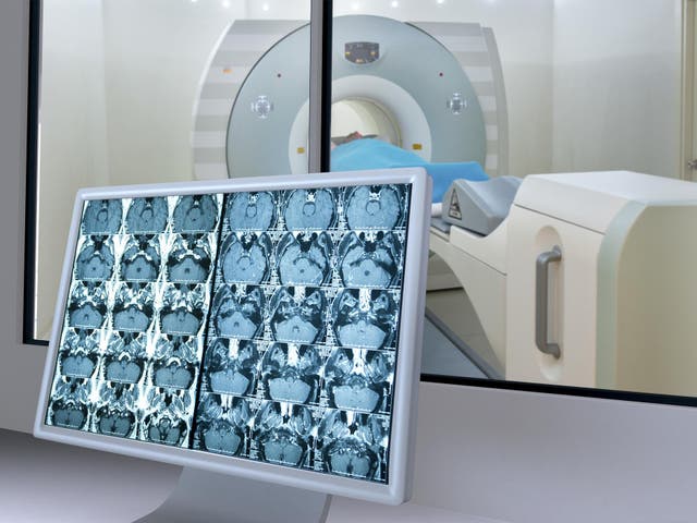 PET scans of 200 people's brains were used to measure their 'metabolic age' in a new study