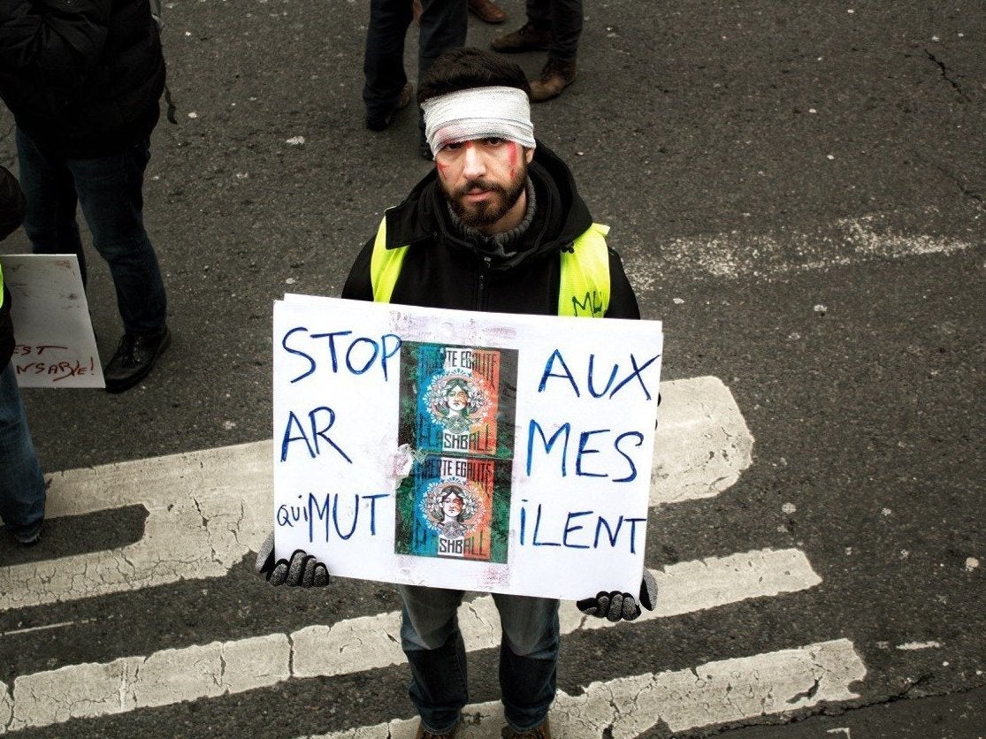 ‘Stop the weapons that mutilate’: a gilets jaunes protester holds a placard denouncing police violence