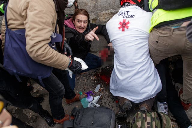 Street medics attend to a protester who lost four fingers during clashes with police in Paris