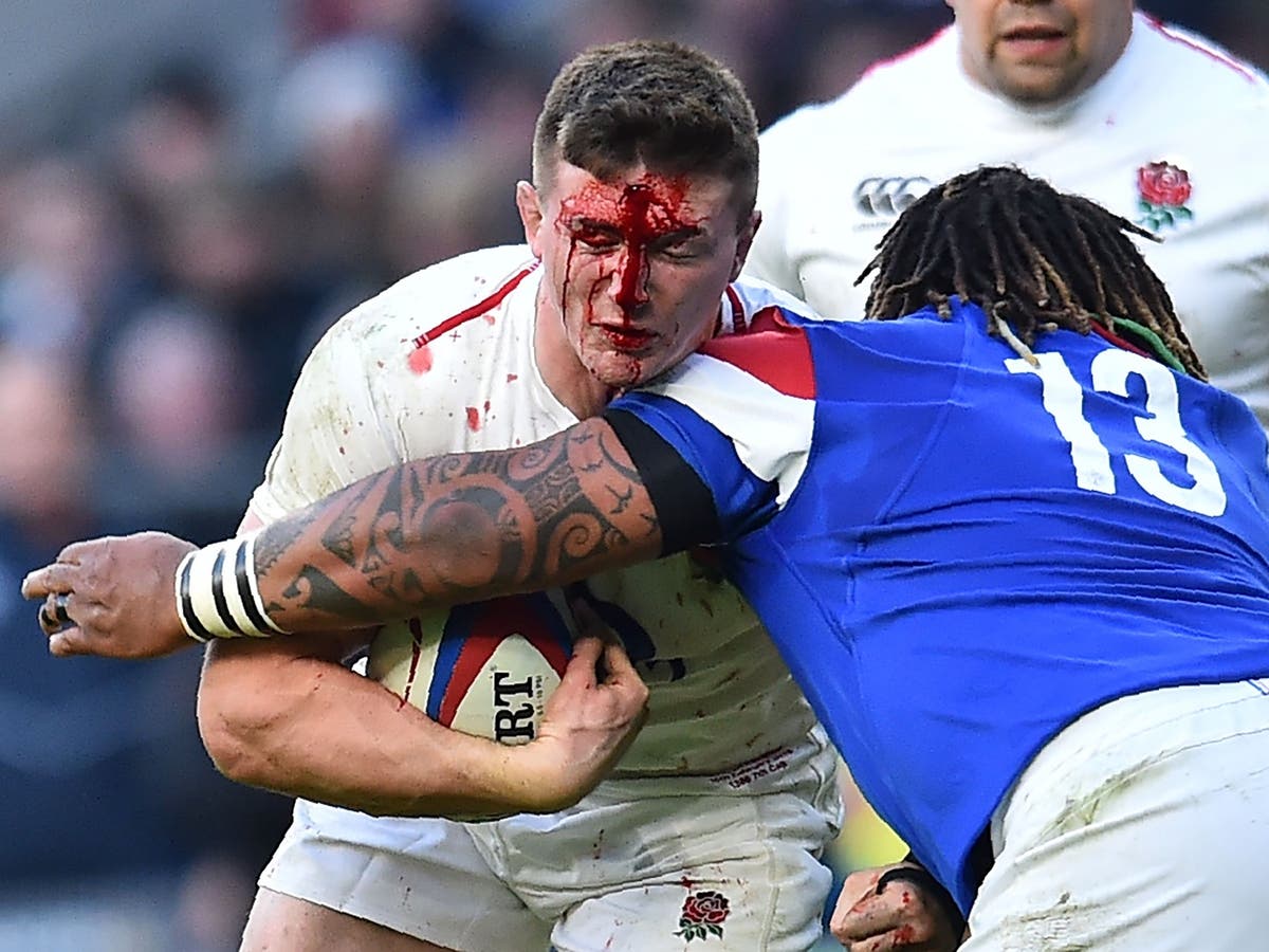 Six Nations: Tom Curry brushes aside his Terry Butcher-like war wounds to  give England its bite back | The Independent | The Independent