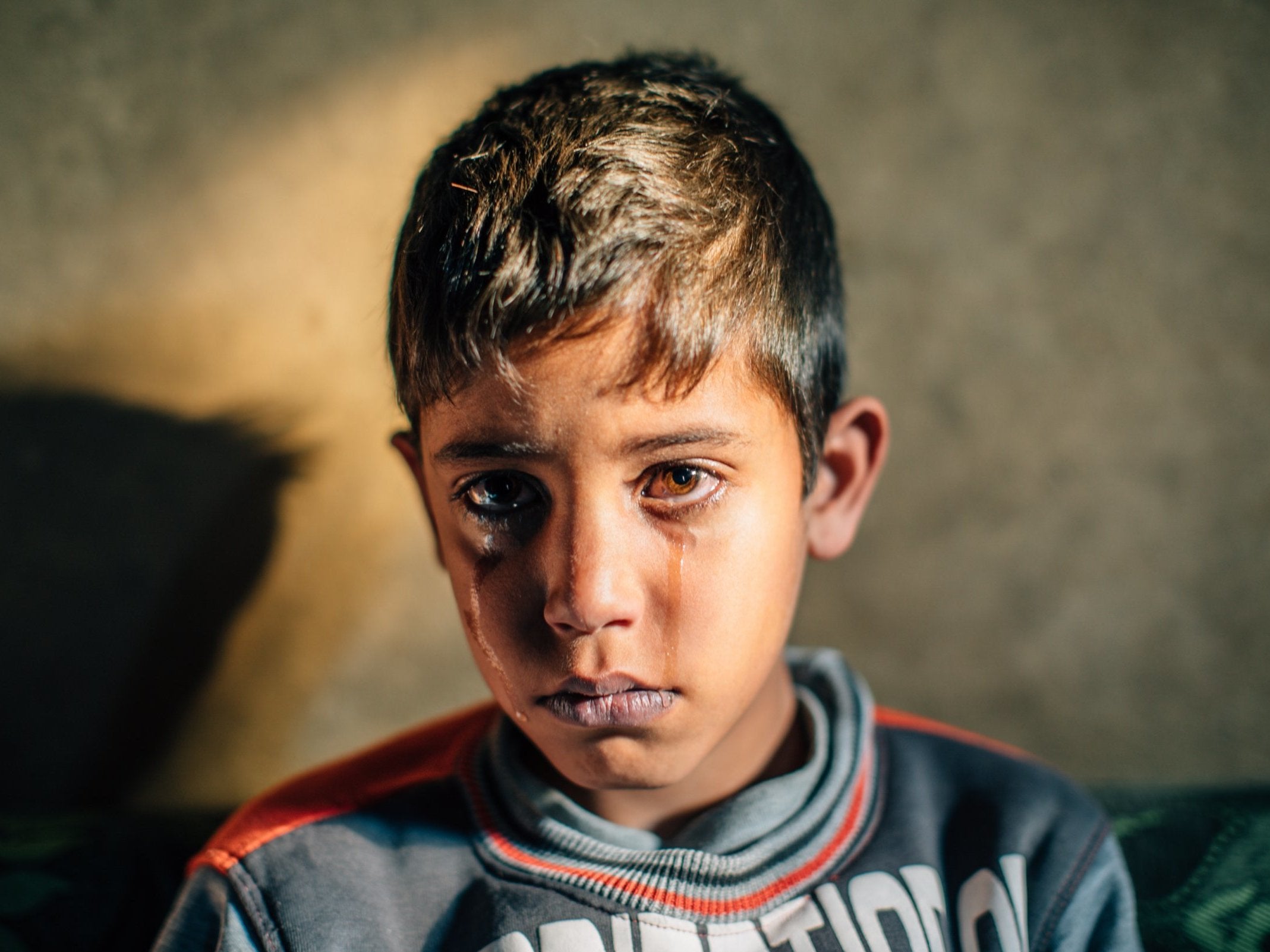 Refugee Abdul Al Moamen, 10, is two years overdue a life saving operation to his heart and understands the implications for his future