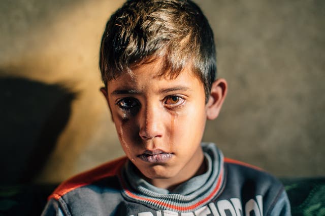 Refugee Abdul Al Moamen, 10, is two years overdue a life saving operation to his heart and understands the implications for his future