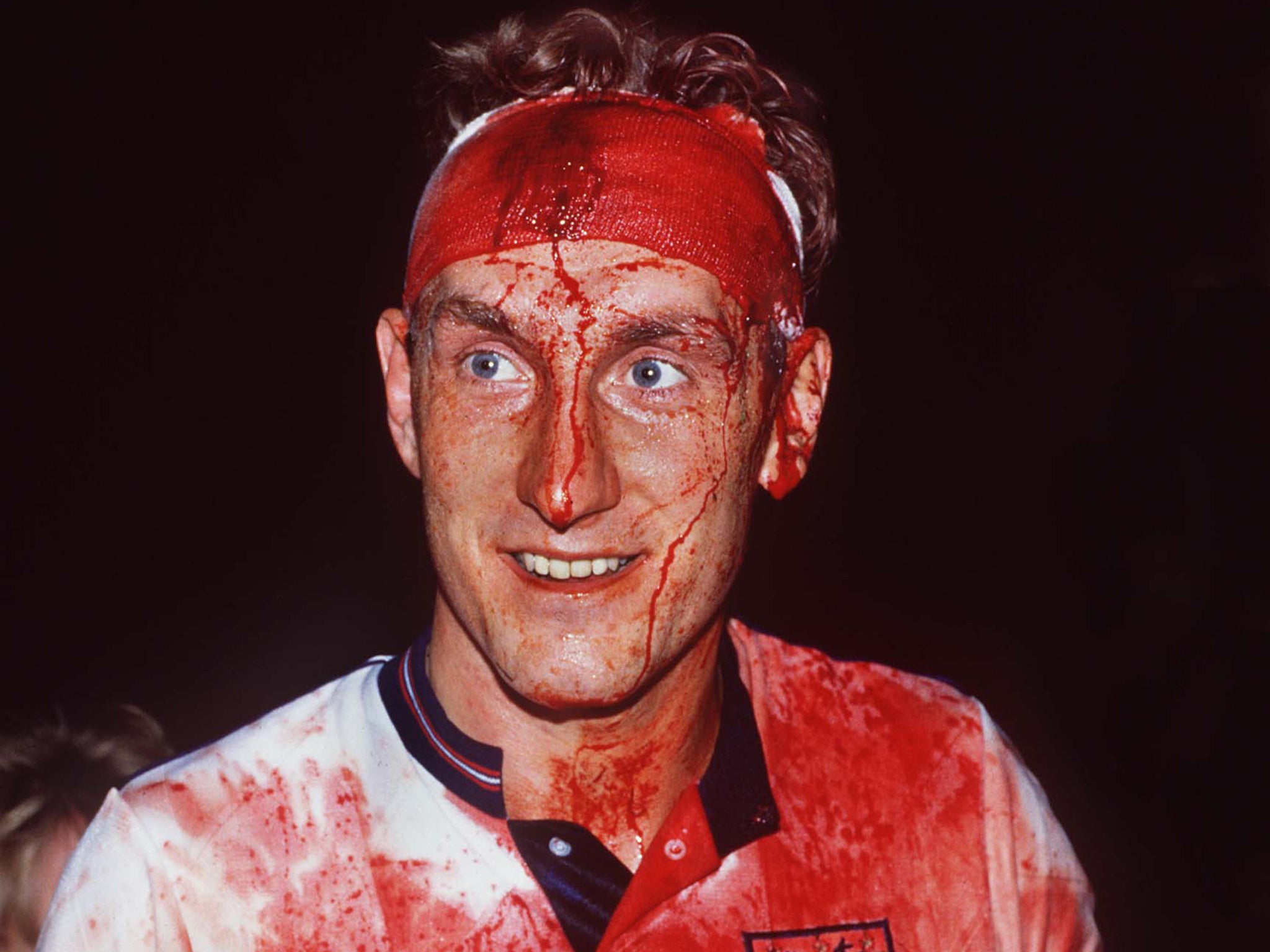 Terry Butcher was left covered in blood during England's match against Sweden in 1989