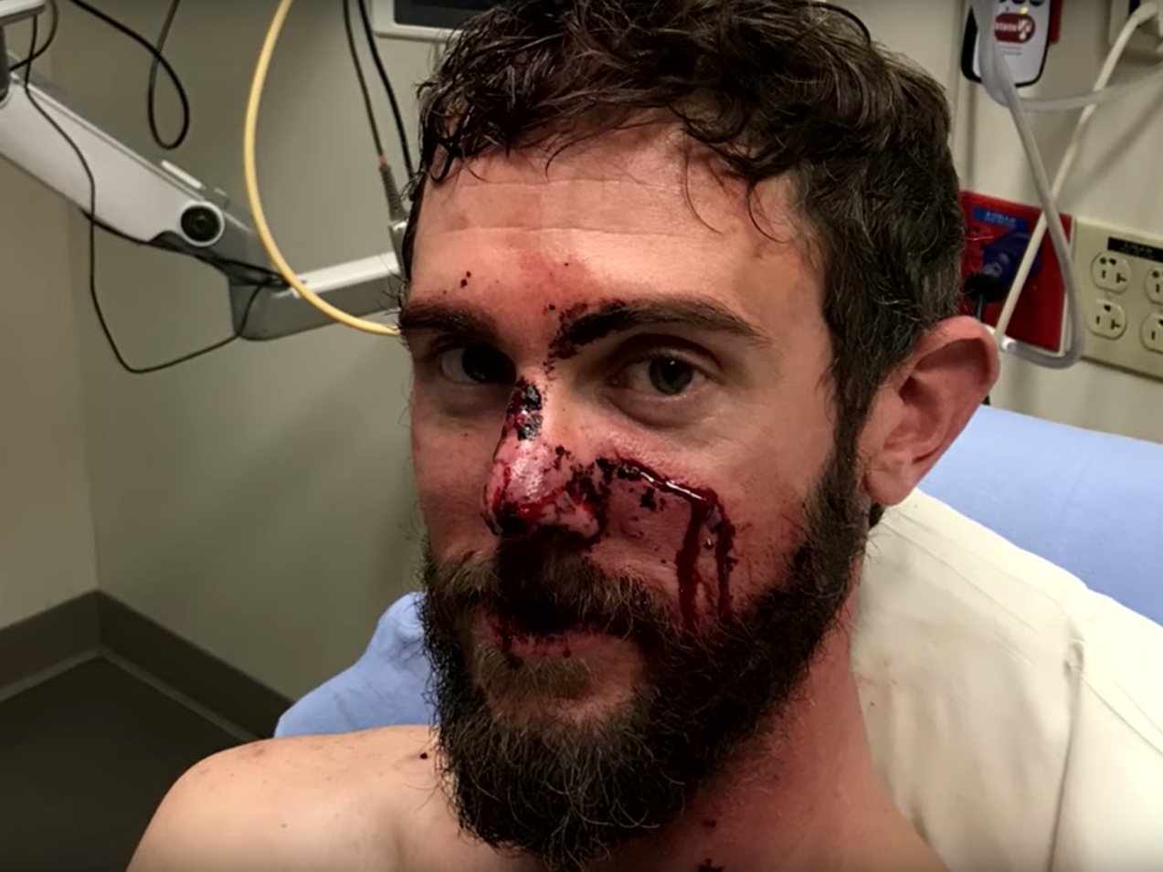 Travis Kauffman survived an attack by a mountain lion after wrestling the animal and eventually suffocating it with his foot on its throat
