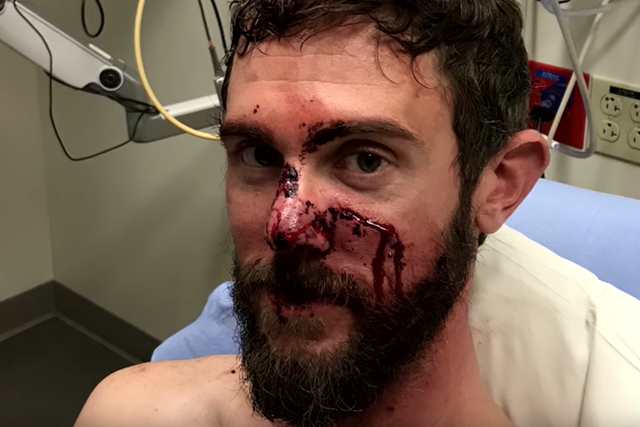 Travis Kauffman survived an attack by a mountain lion after wrestling the animal and eventually suffocating it with his foot on its throat
