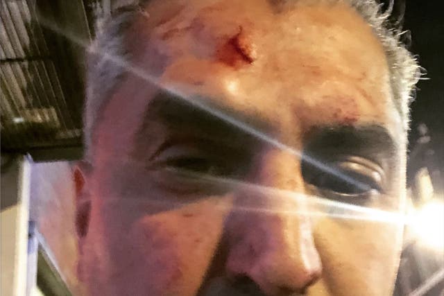 LBC presenter and anti-extremism campaigner Maajid Nawaz said eh was attacked by a man who shouted a racial slur at him
