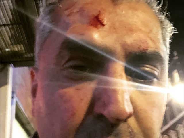 LBC presenter and anti-extremism campaigner Maajid Nawaz said eh was attacked by a man who shouted a racial slur at him