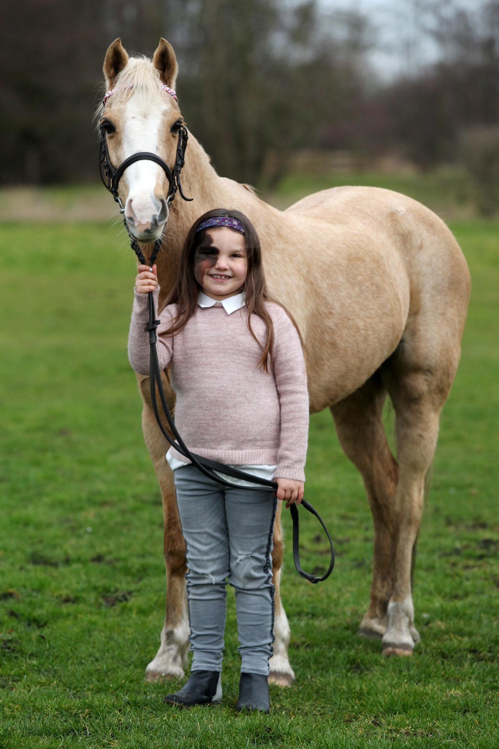 Seven-year-old Rosabella will feature in the exhibition alongside other children and adults with CMN (SWNS)
