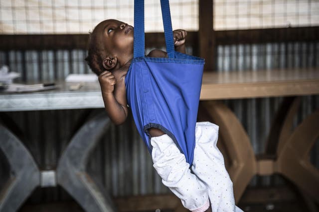 An emaciated child is weighed at a camp for displaced people in Juba