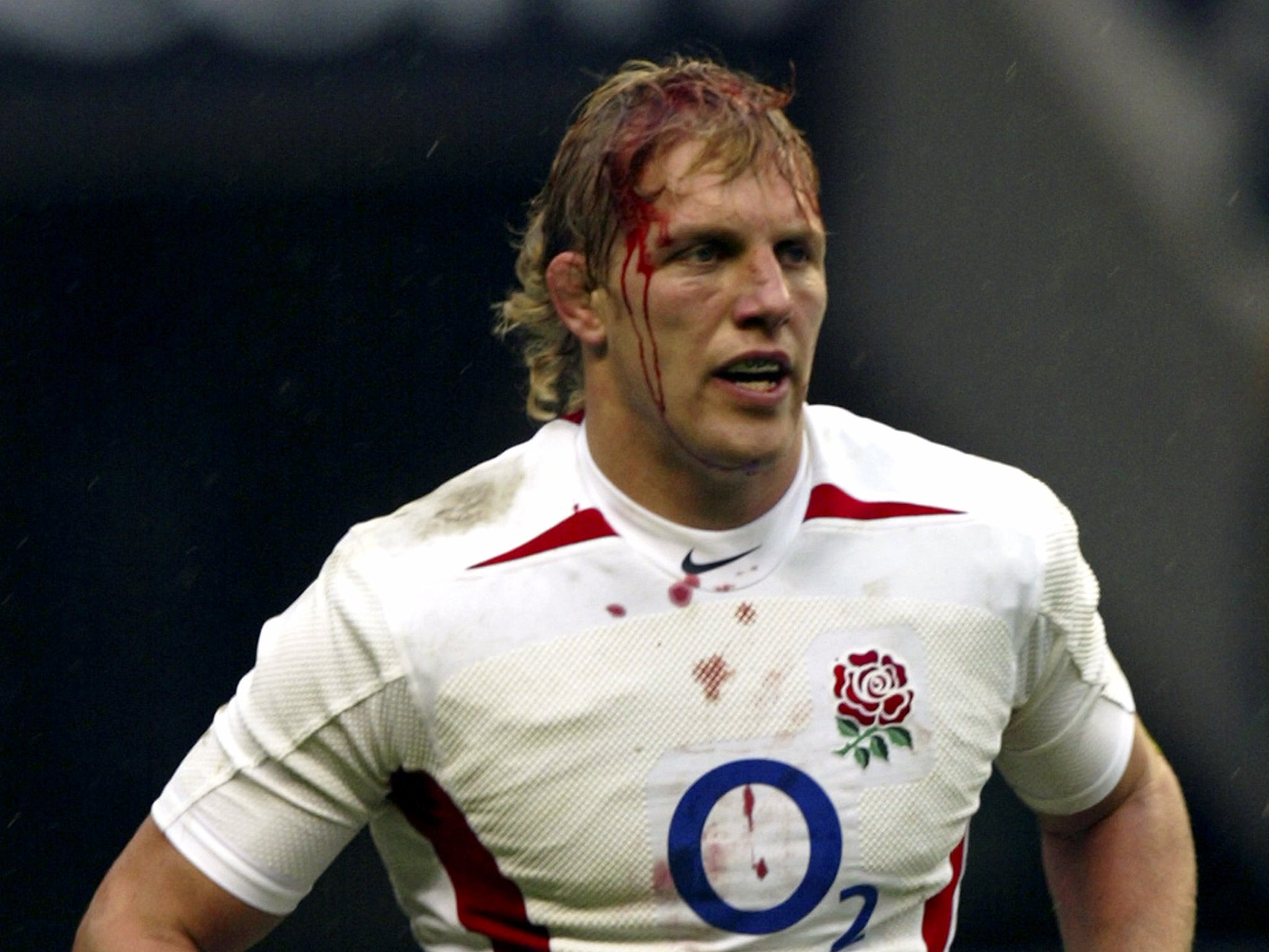 England’s Lewis Moody is left with blood pouring from his head after a collision