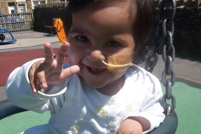 Imaan, now two, still requires a nasogastric tube, has weak cries from damage to her lungs, and is not developing as fast as her peers, her father Gazanfer Ali says