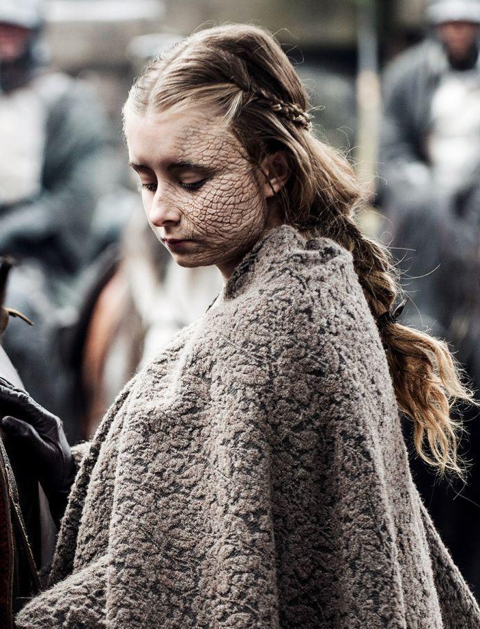 52. Shireen Baratheon