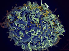 HIV patient in Dusseldorf could be third person ‘cured’ of virus