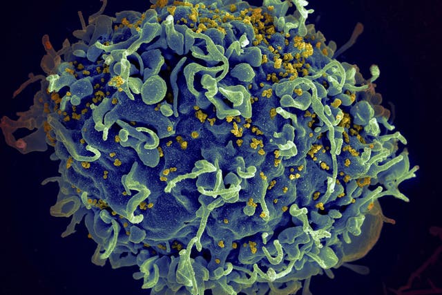 HIV (yellow) attacks human immune cells (blue) and can be kept suppressed with anti-retroviral drugs but before "Berlin patient" Timothy Ray Brown there was thought to be no cure