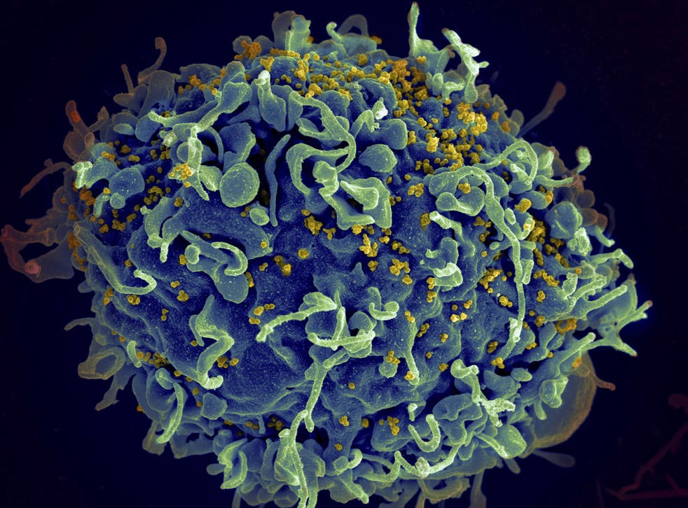 HIV (yellow) attacks human immune cells (blue) and can be kept suppressed with anti-retroviral drugs, but there was previously thought to be no ‘cure’