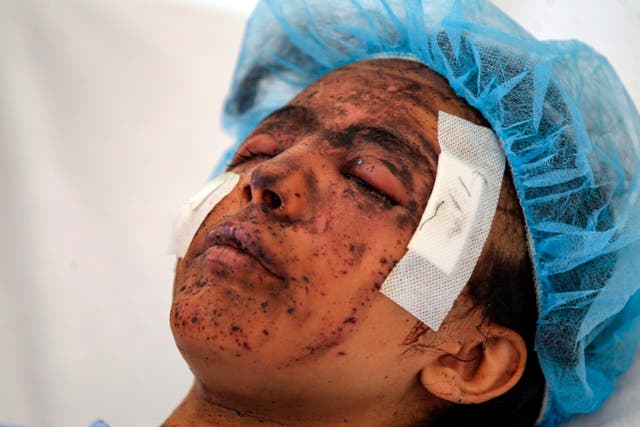 A Yemeni girl receives treatment at a hospital in the Huthi-rebel-held capital Sanaa on March 11, 2019, from wounds sustained during a reported air strike in the Kisar district of the northern Hajjah province