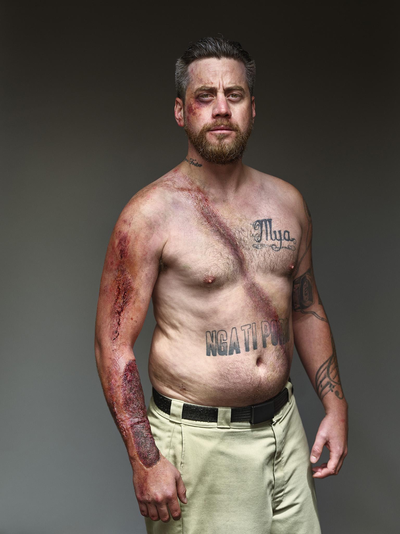Belt Up Brutal Advertising Campaign Targets Young Men Who