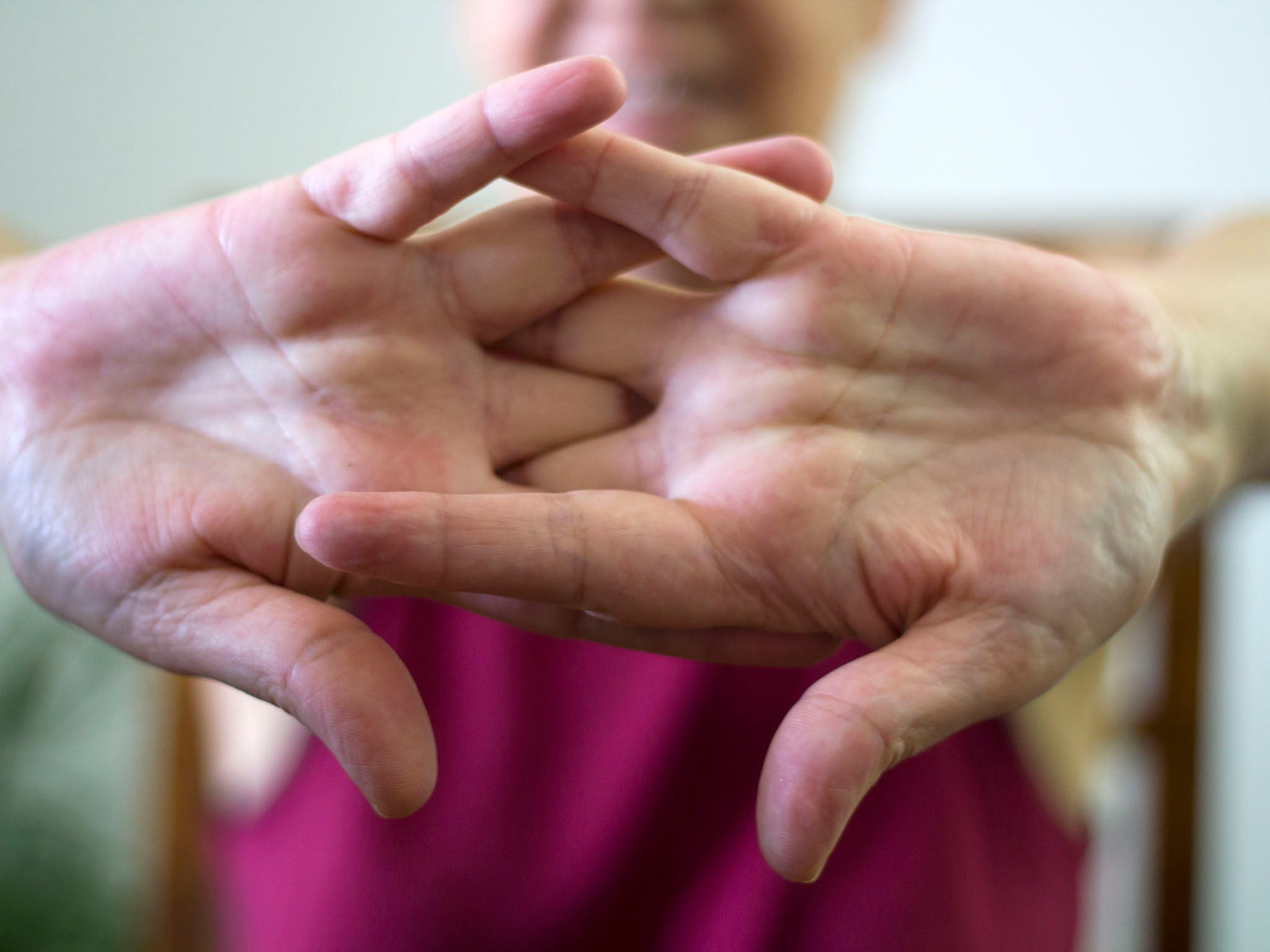 It’s a myth that cracking your knuckles causes arthritis