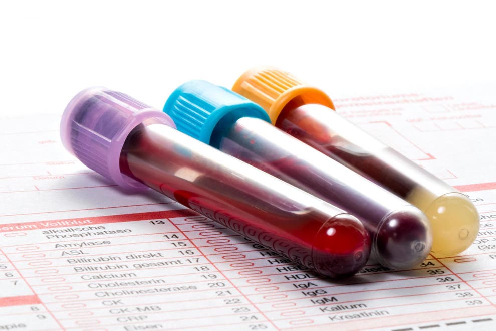 endometriosis-new-blood-test-may-be-able-to-detect-the-condition-but