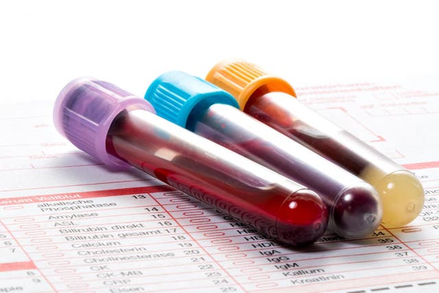 Blood test may be able to detect endometriosis (Stock)