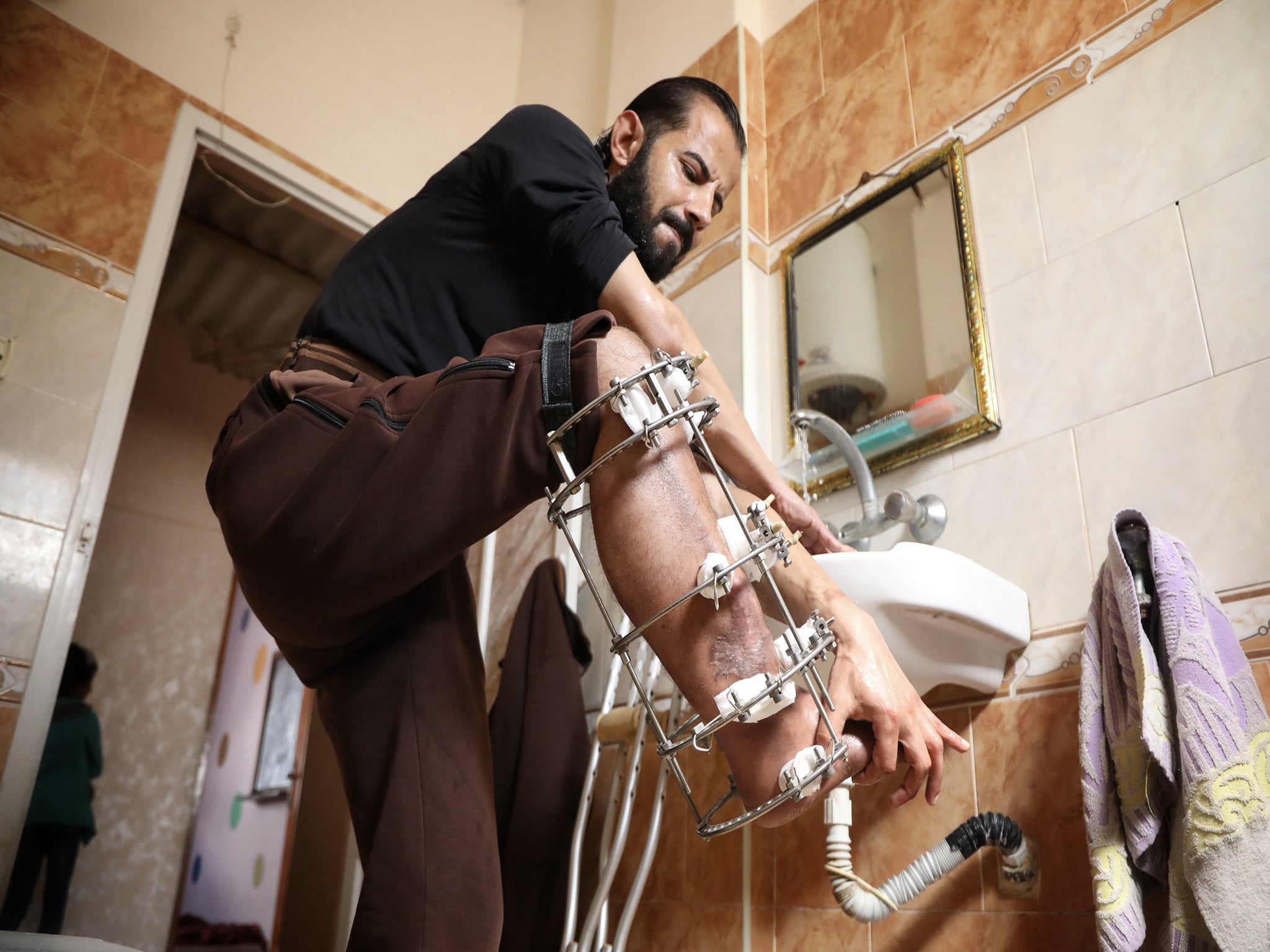 Mohammed Mikdad adjusts his leg brace every six hours to help mend his shattered leg