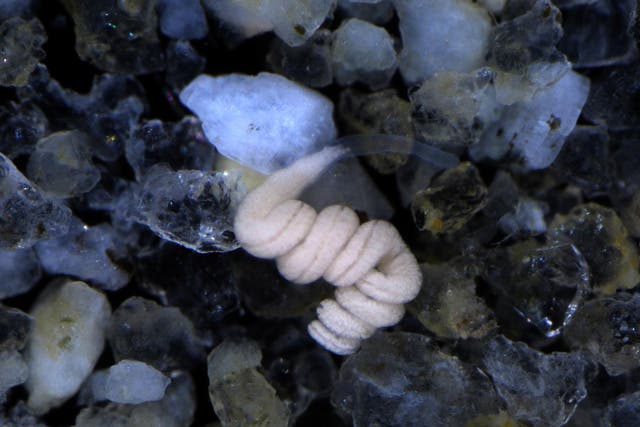 The white coloration of Paracatenula worms comes from the bacterial symbionts living inside them