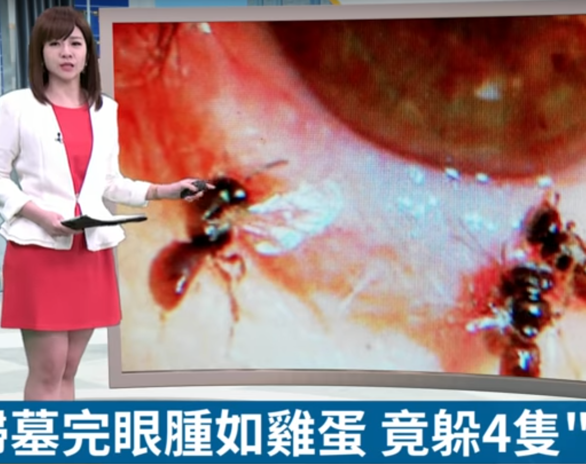Four ‘sweat bees’ were found wriggling around beneath 29-year-old Ms He’s eyelid