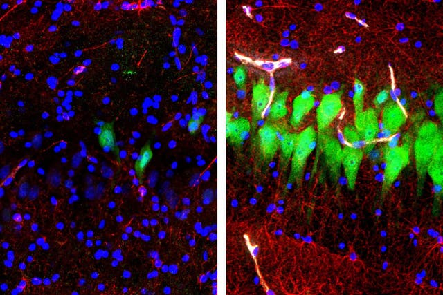 Immunofluorescent stains for neurons and cell nuclei in the brain: untreated for 10 hours after death (left) and subjected to perfusion with the BrainEx technology (right)