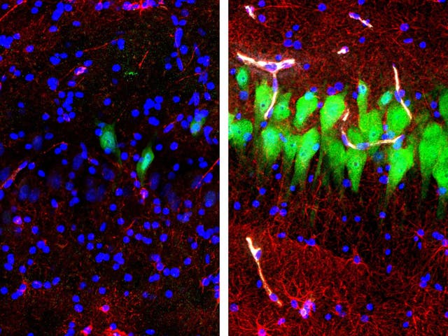 Immunofluorescent stains for neurons and cell nuclei in the brain: untreated for 10 hours after death (left) and subjected to perfusion with the BrainEx technology (right)