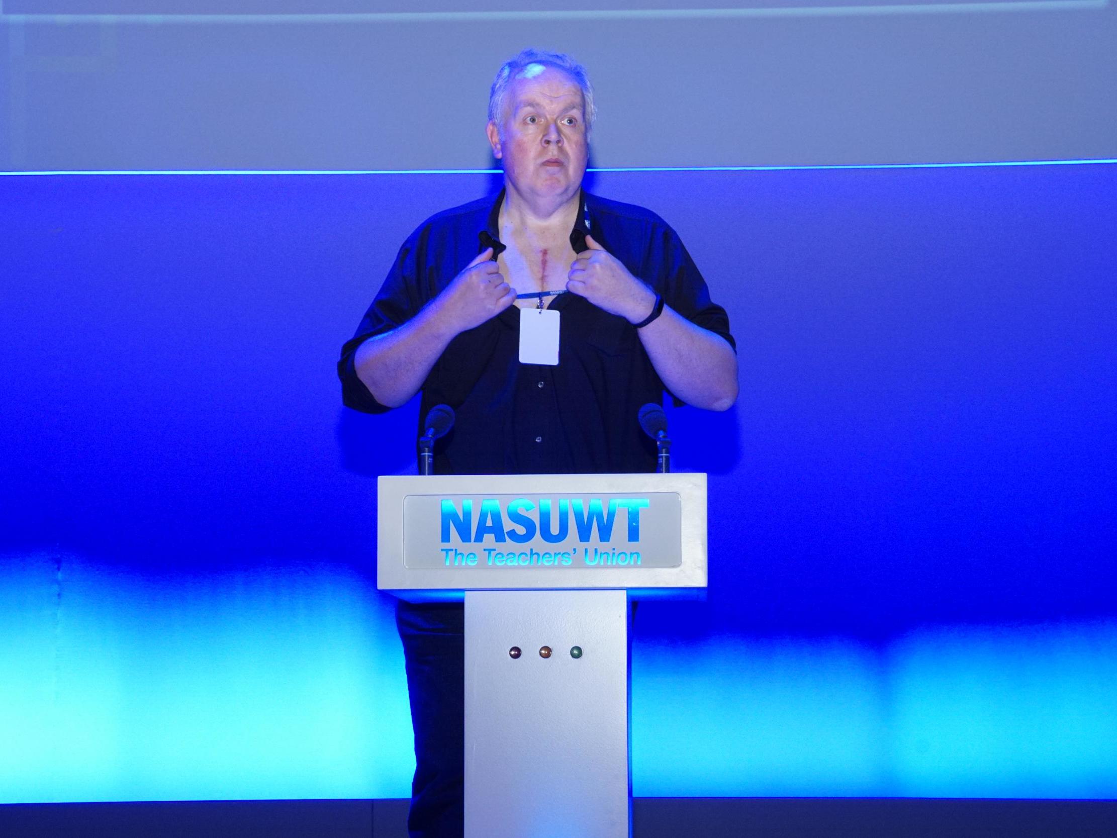 Neil Jeffery, a teacher from Oxford, revealed a triple heart bypass surgery scar as he addressed the NASUWT annual conference in Belfast