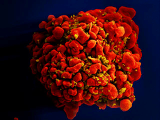 Aids breakthrough as study finds drugs prevent transmission of HIV
