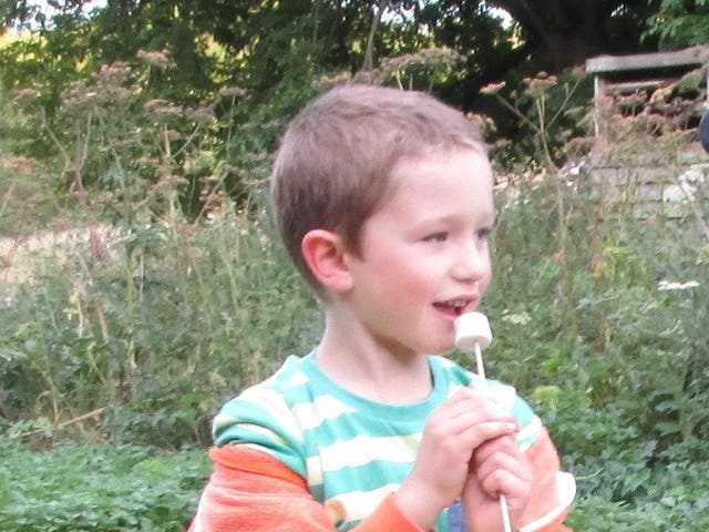 Sebastian Hibberd died in 2015 after the NHS 111 service failed to identify the seriousness of his condition and his parents were unable to get a GP appointment