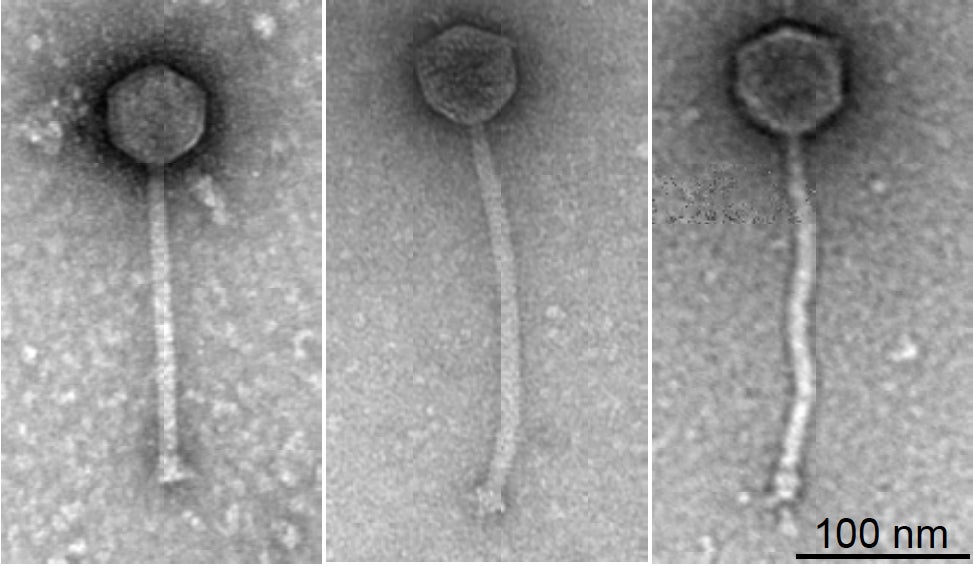 All three phages (Muddy, BPs, and ZoeJ, shown, left to right, in electron micrographs) used to treat the infection had been catalouged as part of research projects and were never intended for medical use