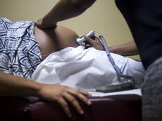 Black women in US three times more at risk of pregnancy-related deaths