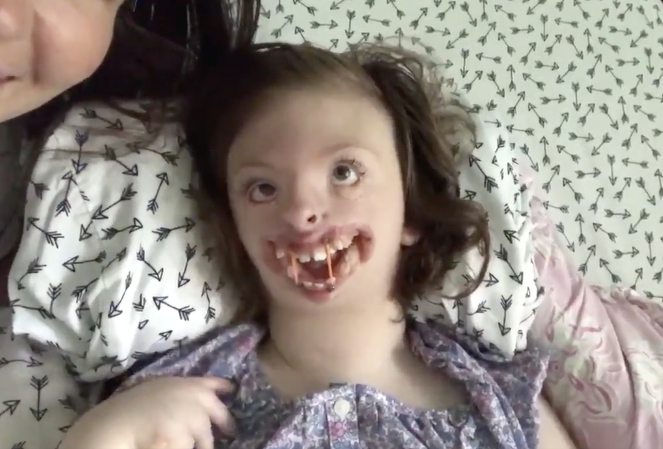 Girl with brain damage who suffered vile online abuse over her facial deformities has died aged 10