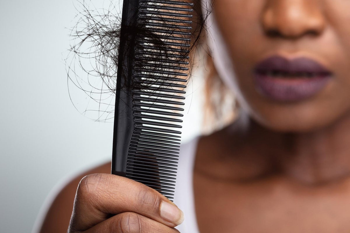 Baldness classified as disability in landmark tax ruling for wig maker