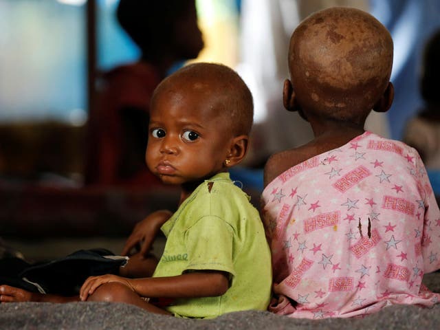 Ntumbabu Kalubi, 4, and his sister Ntumba Kalubi, 2, internally displaced and severely acute malnourished children wait to receive medical attention at the Tshiamala general referral hospital of Mwene Ditu in Kasai Oriental Province in the Democratic Republic of Congo, on 15 March 2018.