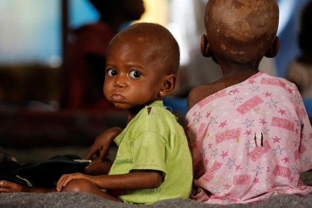 Ntumbabu Kalubi, 4, and his sister Ntumba Kalubi, 2, internally displaced and severely acute malnourished children wait to receive medical attention at the Tshiamala general referral hospital of Mwene Ditu in Kasai Oriental Province in the Democratic Republic of Congo, on 15 March 2018.