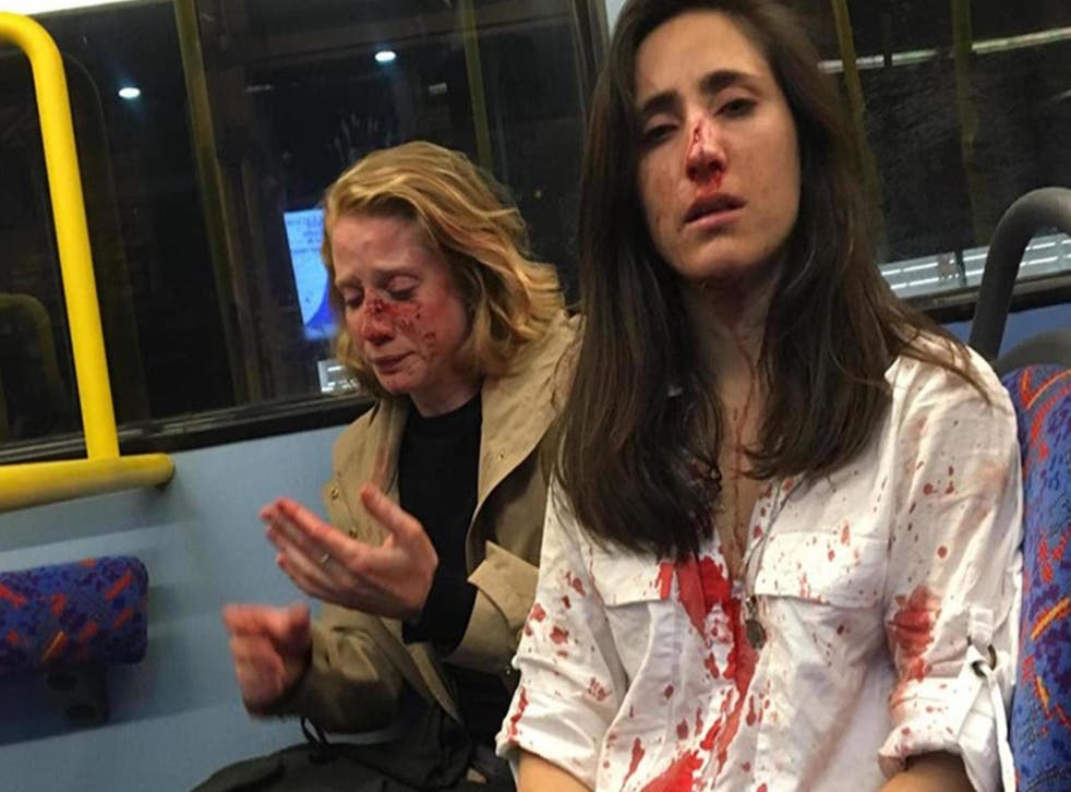 Melania Geymonat posted a picture on Facebook of herself and her girlfriend covered in blood