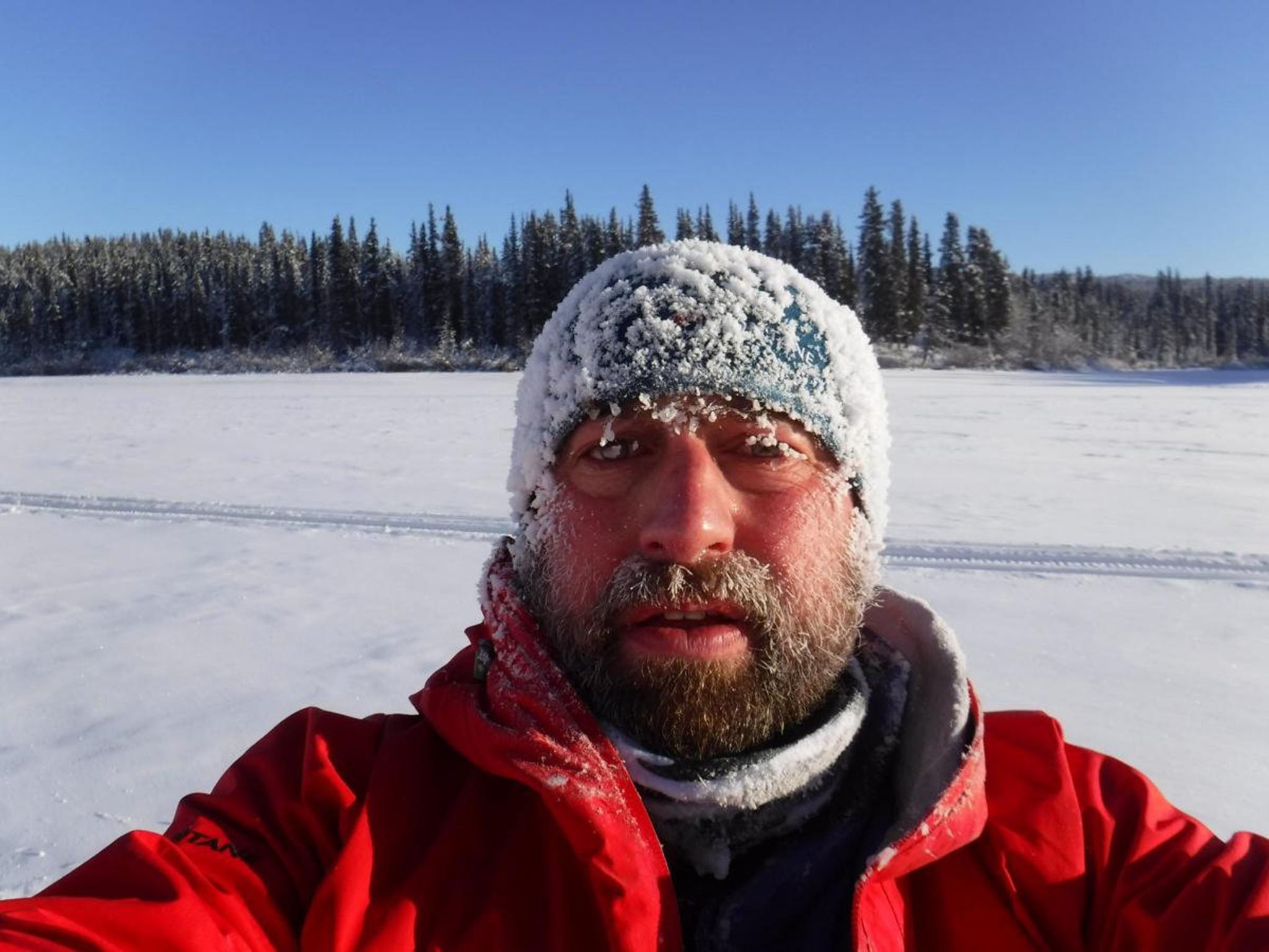 Nick Griffiths, 46, was forced to drop out of the Yukon Arctic race after suffering from severe frostbite