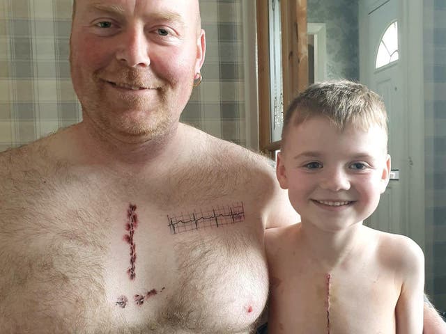 Father gets tattoo on chest to match son's heart surgery scar | The  Independent | The Independent