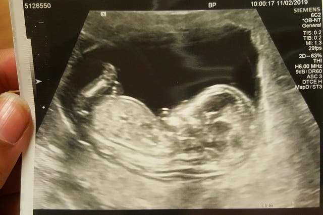 An ultrasound photograph posted on Facebook by stabbing victim Kelly-Mary Fauvrelle