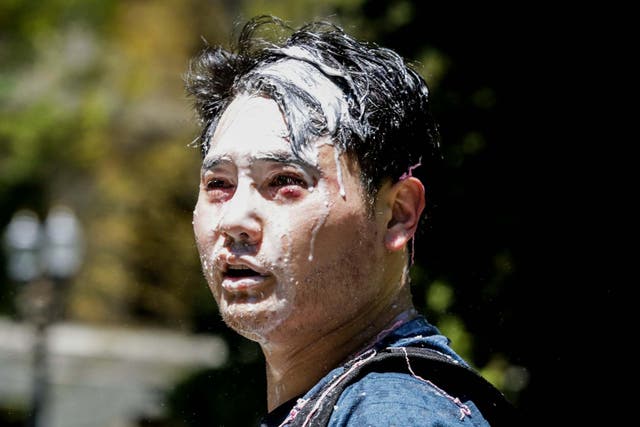 Andy Ngo, a Portland-based journalist, following an attack by antifa demonstrators in Portland, Oregon, on 29 June