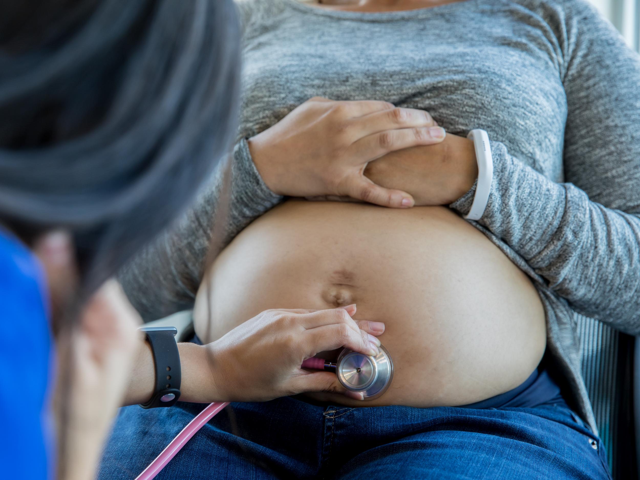 Higher rates of maternal deaths and stillbirths among black mothers are 'tip of the iceberg', experts say