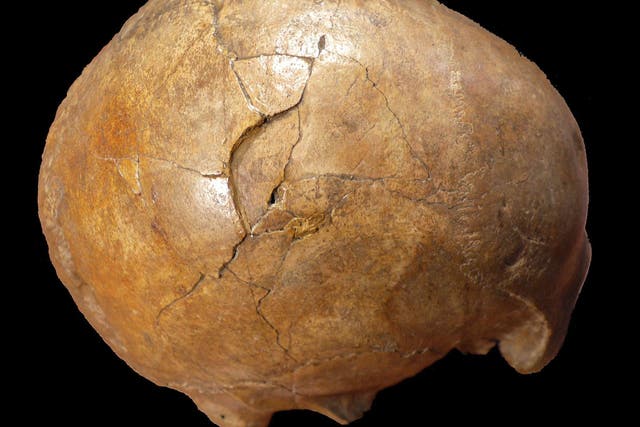 The fossilized skull of the paleolithic adult man was found by miners digging for phosphate. The source of the trauma (pictured) has long been disputed