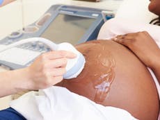 Why are black babies more likely to be stillborn? Institutional racism