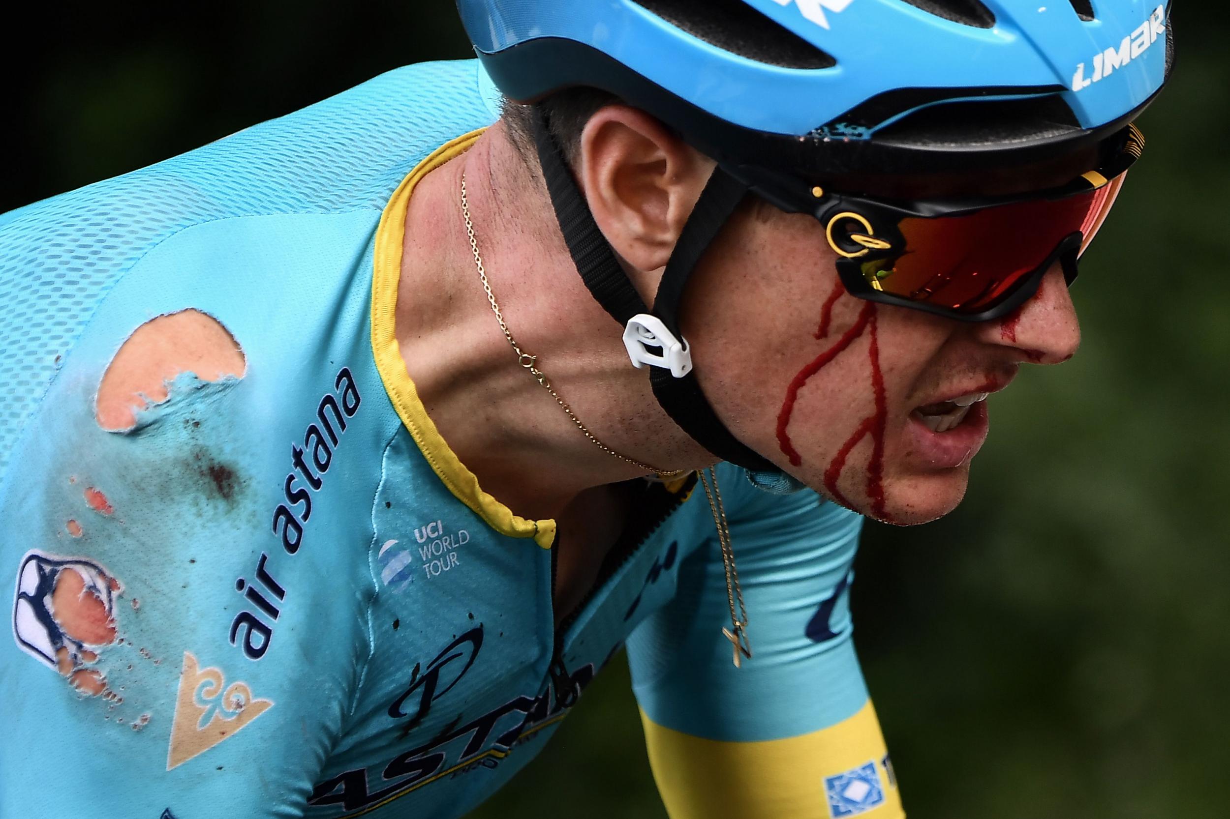 Jakob Fuglsang carries the wounds of a crash