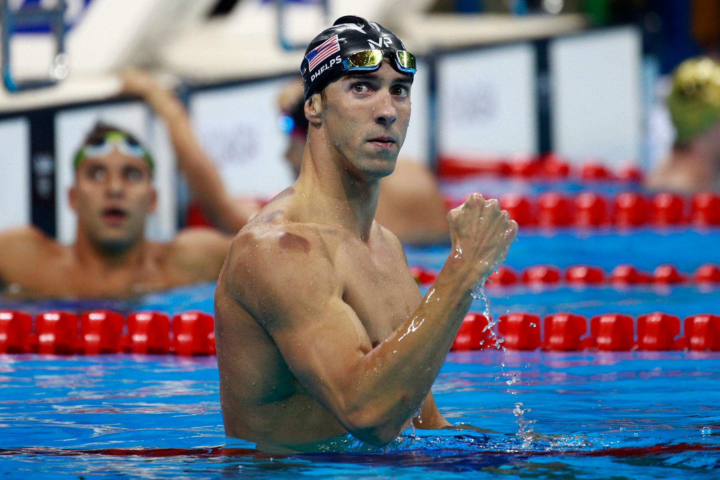 Michael Phelps described the comedown after an Olympic gold medal as a "darkness"